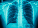 learn more