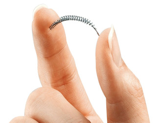 Bayer Essure