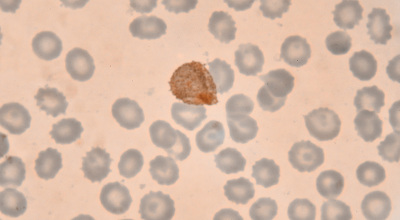 Investigating the Quality of Antimalarial Generic Medicines Using Portable Near-Infrared Spectroscopy
