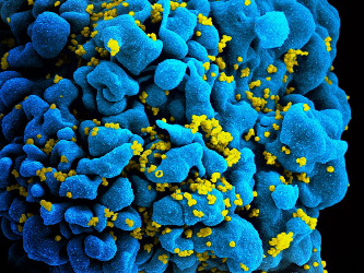 NIH, Partners Launch HIV Vaccine Efficacy Study