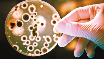 Microbiological Data Integrity: Points to Consider Regarding Second Analyst Verification