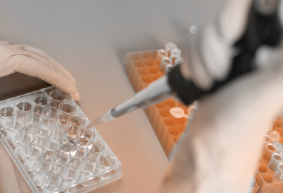 Endotoxin Testing