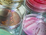 Modern Perspectives on LAL Non-Endotoxin Reactivity