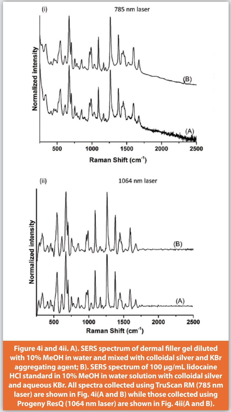 Figure 4i and 4ii. A). SERS spectrum of dermal filler gel diluted with 10% MeOH in water and mixed with colloidal silver and KBR aggregating agent; B). SERS spectrum of 100 µg/mL lidocaine HCl standard in 10% MeOH in water solution with colloidal silver and aqueous KBr. All the spectra collected using TruScan RM (785 nm laser) are shown in Fig. 4i(A and B) while those collected using Progeny ResQ (1064 nm laser) are shown in Fig. 4ii(A and B).
