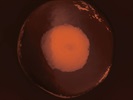Detecting Trace Elements in Single Cells with ICP-MS