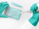 Navigating the Complex Testing Strategies for Viral Vector-based Gene Therapies