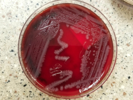 Validating Alternative Microbiological Methods:   A Guide to USP  and  Validation of Rapid Methods
