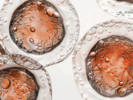 Unlocking Affordability:  How Global Patient Registries Transform  Affordability of  Cell/Gene Therapies