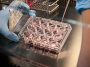 Recent Advances in Pharmaceutical Microbiology and Ongoing Challenges