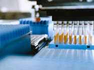 Unlocking Productivity: How Advanced Technologies Are Transforming Microbial Quality Control in Pharma