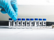Spectroscopic Insights into Cytostatic Drug Stability and Degradation