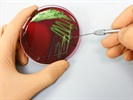 Microbial Detection Systems