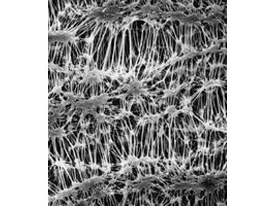 Fluoropore Membranes (hydrophobic)