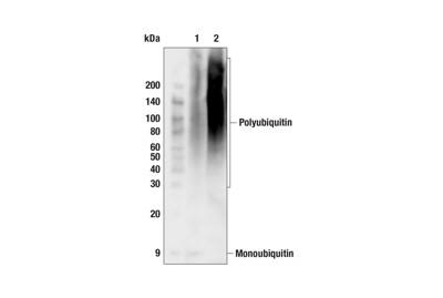 Pan-branch Ubiquitin TUBE-UBQLN1 (Magnetic Bead Conjugate)
